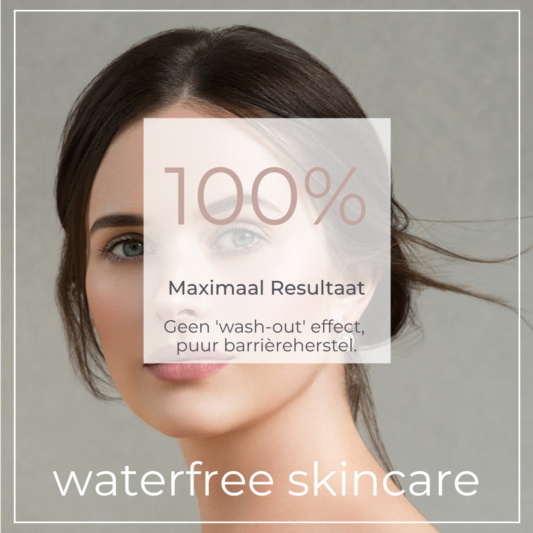 100% Maximaal Resultaat